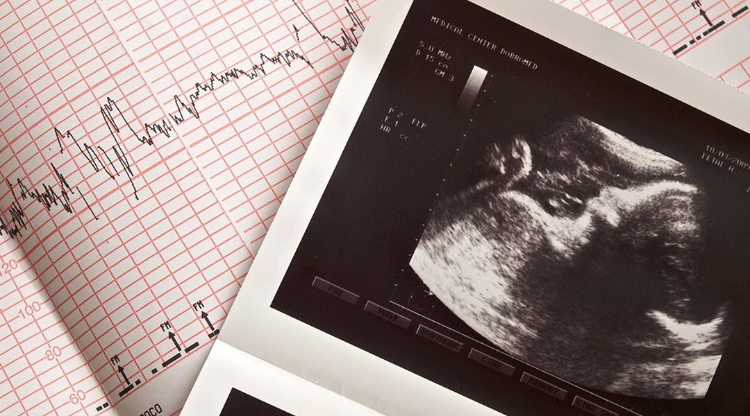 O ecocardiograma fetal deve ser feito com quantas semanas de gestação?