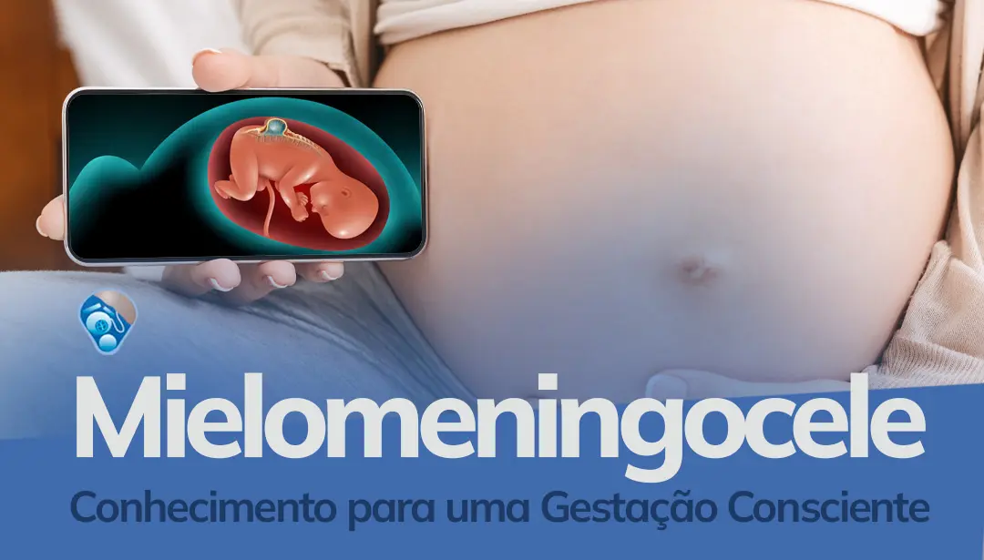 Mielomeningocele: Conhecimento para uma Gestação Consciente